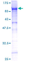 ab158361 on a 12.5% SDS-PAGE stained with Coomassie Blue.