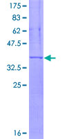 ab158776 on a 12.5% SDS-PAGE stained with Coomassie Blue.