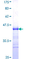 ab159765 on a 12.5% SDS-PAGE stained with Coomassie Blue.