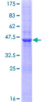 ab161306 on a 12.5% SDS-PAGE stained with Coomassie Blue.