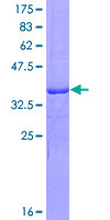 ab161307 on a 12.5% SDS-PAGE stained with Coomassie Blue.