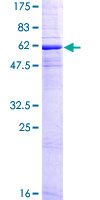 ab158047 on a 12.5% SDS-PAGE stained with Coomassie Blue.