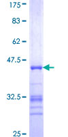 ab158048 on a 12.5% SDS-PAGE stained with Coomassie Blue.
