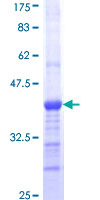 ab158838 on a 12.5% SDS-PAGE stained with Coomassie Blue.