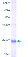ab158051 on a 12.5% SDS-PAGE stained with Coomassie Blue.