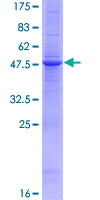 ab159764 on a 12.5% SDS-PAGE stained with Coomassie Blue.