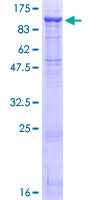 ab158308 on a 12.5% SDS-PAGE stained with Coomassie Blue.