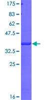 ab158309 on a 12.5% SDS-PAGE stained with Coomassie Blue.