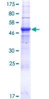 ab165217 on a 12.5% SDS-PAGE stained with Coomassie Blue.