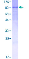 ab158557 on a 12.5% SDS-PAGE stained with Coomassie Blue.