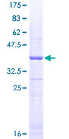 ab158558 on a 12.5% SDS-PAGE stained with Coomassie Blue.