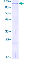 ab158063 on a 12.5% SDS-PAGE stained with Coomassie Blue.