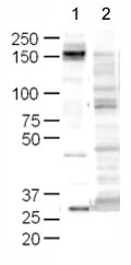 All lanes : Anti-CD45 antibody ( ab10558 ) at 1/500 dilution Lane 1 : Jurkat Whole Cell Lysate Lane 2 : Jurkat Whole Cell Lysate with Human CD45 peptide (ab17553) Lysates/proteins at 20 µg per lane. Secondary Goat Anti-Rabbit IgG H&L (HRP) ( ab6721 ) at 1/5000 dilution