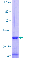 ab159285 on a 12.5% SDS-PAGE stained with Coomassie Blue.
