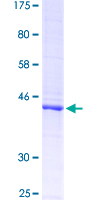 ab159286 on a 12.5% SDS-PAGE stained with Coomassie Blue.