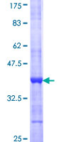 ab153281 on a 12.5% SDS-PAGE stained with Coomassie Blue.