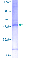 ab158064 on a 12.5% SDS-PAGE stained with Coomassie Blue.