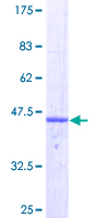 ab158067 on a 12.5% SDS-PAGE stained with Coomassie Blue.