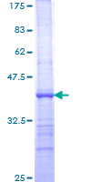 ab159508 on a 12.5% SDS-PAGE stained with Coomassie Blue.