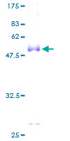 ab158045 on a 12.5% SDS-PAGE stained with Coomassie Blue.