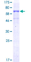 ab160890 on a 12.5% SDS-PAGE stained with Coomassie Blue.