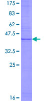 ab164423 on a 12.5% SDS-PAGE stained with Coomassie Blue.