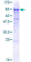 ab164330 on a 12.5% SDS-PAGE stained with Coomassie Blue.