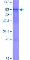 ab164344 on a 12.5% SDS-PAGE stained with Coomassie Blue.