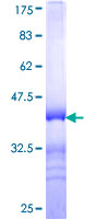 ab164345 on a 12.5% SDS-PAGE stained with Coomassie Blue.