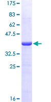 ab160092 on a 12.5% SDS-PAGE stained with Coomassie Blue.