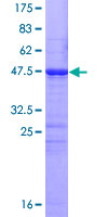 ab165789 on a 12.5% SDS-PAGE stained with Coomassie Blue.