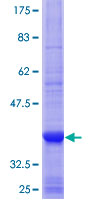 ab165790 on a 12.5% SDS-PAGE stained with Coomassie Blue.