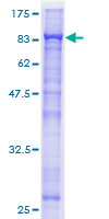 ab152908 on a 12.5% SDS-PAGE stained with Coomassie Blue.