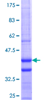 ab152909 on a 12.5% SDS-PAGE stained with Coomassie Blue.