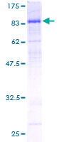 ab158074 on a 12.5% SDS-PAGE stained with Coomassie Blue.
