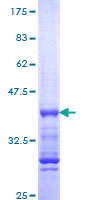 ab158075 on a 12.5% SDS-PAGE stained with Coomassie Blue.