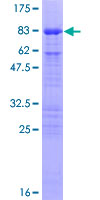 ab158076 on a 12.5% SDS-PAGE stained with Coomassie Blue.