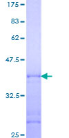 ab158070 on a 12.5% SDS-PAGE stained with Coomassie Blue.