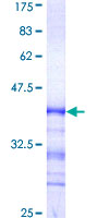 ab160115 on a 12.5% SDS-PAGE stained with Coomassie Blue.