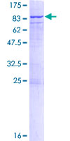 ab161531 on a 12.5% SDS-PAGE stained with Coomassie Blue.