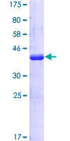 ab161532 on a 12.5% SDS-PAGE stained with Coomassie Blue.