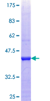 ab161533 on a 12.5% SDS-PAGE stained with Coomassie Blue.