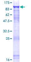 ab162521 on a 12.5% SDS-PAGE stained with Coomassie Blue.