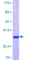 ab162522 on a 12.5% SDS-PAGE stained with Coomassie Blue.