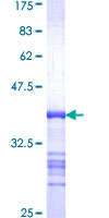 ab160046 on a 12.5% SDS-PAGE stained with Coomassie Blue.