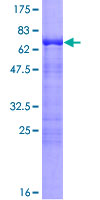 ab161697 on a 12.5% SDS-PAGE stained with Coomassie Blue.