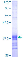 ab161698 on a 12.5% SDS-PAGE stained with Coomassie Blue.