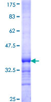 ab163453 on a 12.5% SDS-PAGE stained with Coomassie Blue.