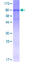 ab159990 on a 12.5% SDS-PAGE stained with Coomassie Blue.