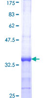 ab159991 on a 12.5% SDS-PAGE stained with Coomassie Blue.
